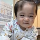 아기 부분합지다지증 수술 “대구 W(더블유)병원” 후기
