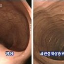 배에 까스가 차면.... 이미지