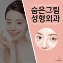숨은그림성형외과