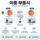 짝눈, 이종 부등시에 빛 번짐까지 - 안경이 늘 힘들었던 고객님 후기