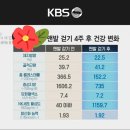 맨발걷기 4주 후 nk세포 30배 증가[생로병사] 이미지