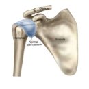 와이필라앤피티 이미지