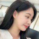 로데오약국 | 압구정로데오 피부과 이마 필러 후기 /추천 /효과/ 비용