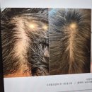 예뻐졌다 | 명지 두피관리 재방문 후기 예뻐졌다 명지오션점