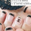 강자안손톱 이미지