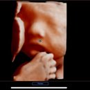 햇빛 | 임신 28주차 햇빛병원 입체초음파 후기