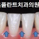 홈플란트치과의원 이미지