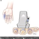 수지메디칼 이미지