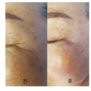 피부에설레다 이미지