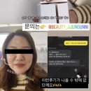 초이스인셀덤