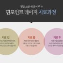 핀포인트 이미지