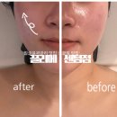 프롭테라피&밴드운동 | 해운대 에스테틱 윤곽관리 추천 끌리메 센텀점 솔직후기