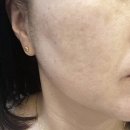 에스테티아천안신불당 | 천안 에스테티아 천안신불당1호점 윤곽관리 후기 얼굴선이 살아나는 관리 경험