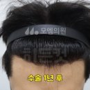 모엠