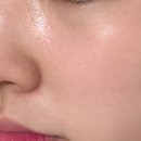 하이포레버 이미지