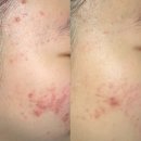 예일피부과의원 이미지