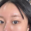 선부광장북로1L | [더예쁜오늘안산선부점]안산선부동 물광케어 스킨부스터