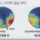 안경찾기 안경원 이미지