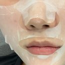 강남역데이원의원 | 강남역데이원의원 티타늄 2주차 후기 리프팅 효과 통증 붓기 내부시설 추천