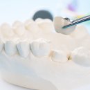 새로치과기공소 이미지