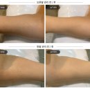 태영프로세스 | 신도림피부관리, 미인본가온 상체 부종 및 인비덤 팔뚝관리 대만족 후기