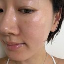 연한풀피부과의원 | 신사역피부과 내돈내산 모공개선 풀페이스 스킨보톡스, 자갈턱 후기