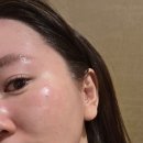 알포유빽스테라피만성점 | 곽인선 아로마스킨 에서 알포유 에너지 테라피로 힐링 관리