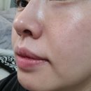 시온뷰티의원 | 서울특별시 송파구 오금동 대상포진 전문병원 추천 | 무료접종 | 예방접종