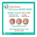 케이톡스의원 인천구월점 | 인천 구월동 발톱 아래 염증이 생기는 이유, 내성발톱과의 연관성 살펴보기