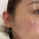 영인케어 이미지