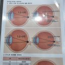 비즈안경 위드렌즈 수원인계점 | 수원 안경 렌즈 저렴한 곳, 비즈안경 위드렌즈 인계동 효도업소 방문기
