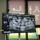 [천안] 매복 사랑니 발치 후기 -‘보스톤 치과’,마취,예약