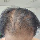 머리나라 이미지