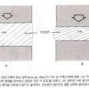 요통(Low Back Pain) Ⅰ. 이미지