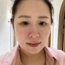 키리스피부관리대구범어점 | 대구 범어동 피부관리 '영 에스테틱 범어점' 만족 케어 후기!