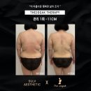 더조각테라피 이미지