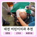 대전 어린이치과 중촌동 선치과 충치치료 후기 7살