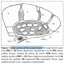 Entrapment neuropathies of the upper extremity - 수근관증후군에 관한 모든 것 이미지