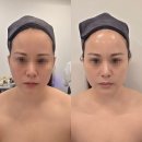 웰식자재마트 | 호매실 에스테틱 어썸웰스파 라운지 수원금곡점 윤곽관리 만족 후기