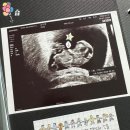 서울아이나여성의원 | 임신 7주~9주 기록 | 서울아이나 여성의원 난임병원 졸업 후기