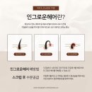 동래왁싱,저통증왁싱 온천장 섬세온왁싱 브라질리언 후기