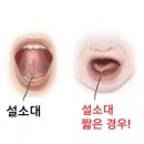 임방울대로 | 광주 소아과 신생아 BCG 접종 &amp; 1차 영유아검진 후기 | 설소대 단축증 수술 (+ 보험청구)