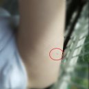 송도유외과의원 네이버블로그