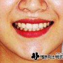 예쁜미소바른이치과의원 이미지