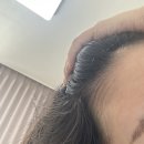 국립식량과학원 화장실 | 닥터방기원 국립산림과학원 특허기술 보리밥나무 탈모 케어, 임산부 머리빠짐 핫한원료!!!