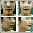 비포성형외과의원 이미지