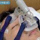 수면 무호흡증 Sleep apnea 이미지