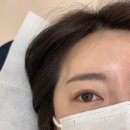 붉은잔흔제거, 호매실동 브로우날다에서 피부가 달라졌어요