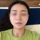 채움아카데미 | 금천구 시흥동 피부관리 맛집루미온느에서 비움채움관리 받고온 후기