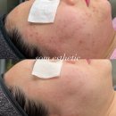 솜 에스테틱 이미지